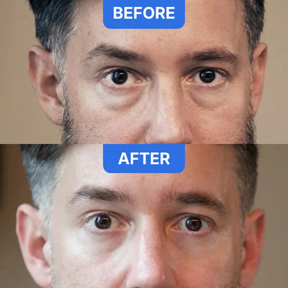 Elumé - Get Your Fresh Look Back